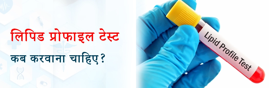 लिपिड प्रोफाइल टेस्ट कब करवाना चाहिए?